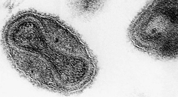 Forgotten Smallpox
