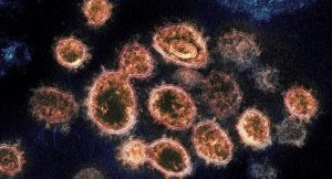 This 2020 electron microscope image provided by the National Institute of Allergy and Infectious Diseases - Rocky Mountain Laboratories shows SARS-CoV-2 virus particles which causes COVID-19, isolated from a patient in the U.S., emerging from the surface of cells cultured in a lab. Coronaviruses, including the newest one, are named for the spikes that cover their outer surface like a crown, or corona in Latin. Using those club-shaped spikes, the virus latches on to the outer wall of a human cell, invades it and replicates, creating viruses to hijack more cells. (NIAID-RML via AP)