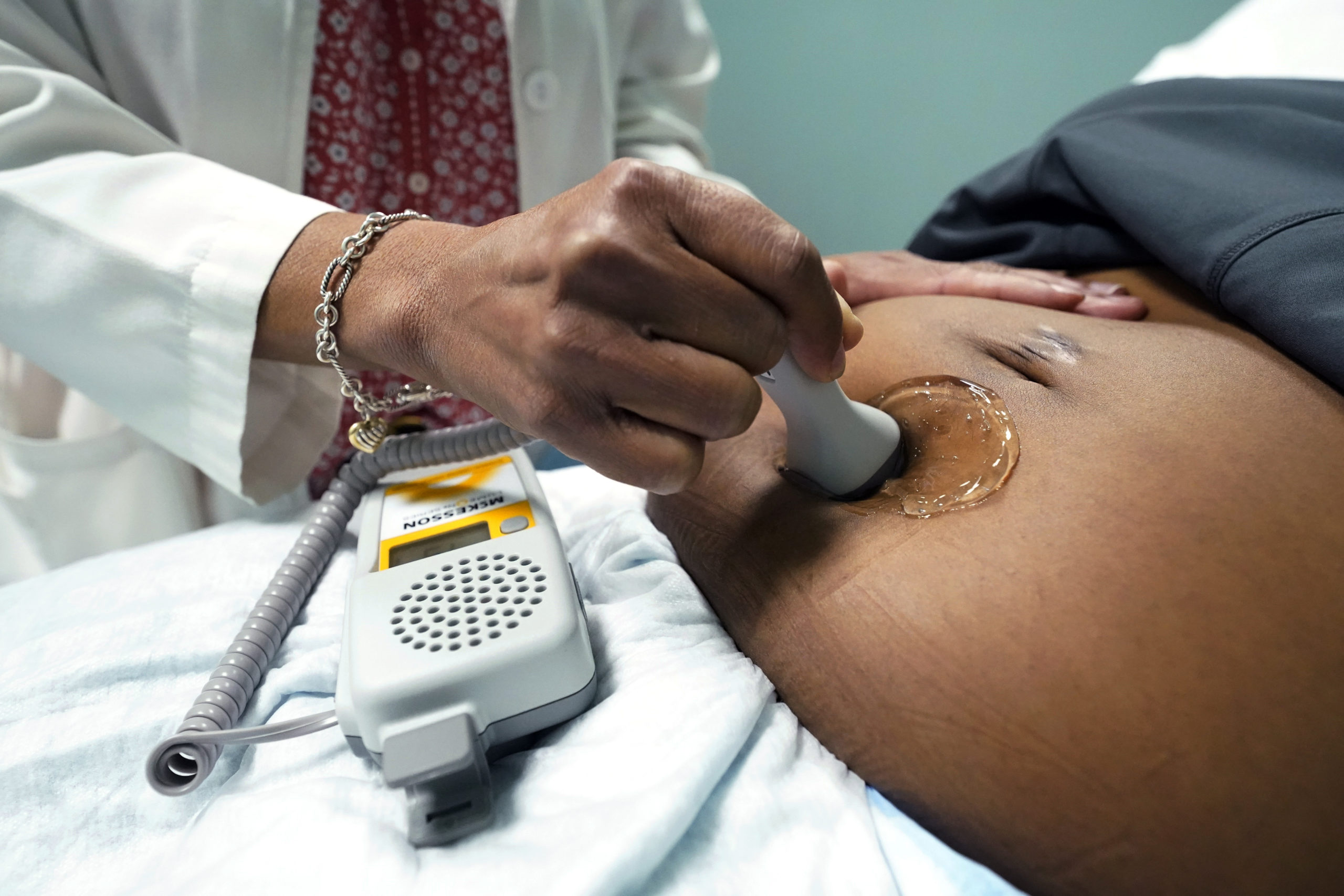 A doctor uses a handheld Doppler probe on a pregnant woman to measure the heartbeat of the fetus on Dec. 17, 2021, in Jackson, Mississippi. COVID-19 drove a dramatic increase in the number of women who died from pregnancy or childbirth complications in the U.S. last year, a crisis that has disproportionately claimed Black and Hispanic women as victims, according to a report released Oct. 19, 2022. (AP Photo/Rogelio V. Solis, File)